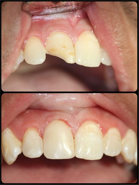 Transformation Tuesday ? #belledental - Belledental - November 12, 2019